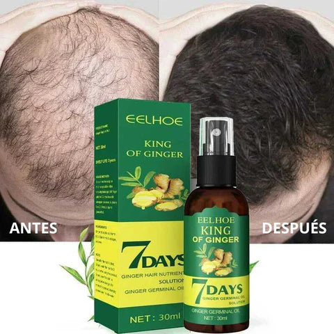 Tonico Capilar Jengibre 7 Days Eelhoe