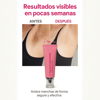NiaGlow™ Crema Corporal Aclarante con Niacinamida