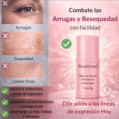 Rosetimes™ Bálsamo Facial Hidratante Antiarrugas, Piel sin Imperfecciones
