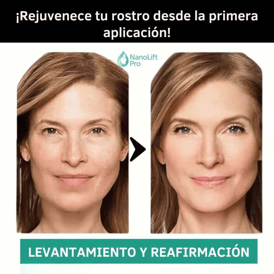 NanoLift Pro™ Parches de Colágeno Rejuvenecimiento Facial Avanzado – Pack Completo x24