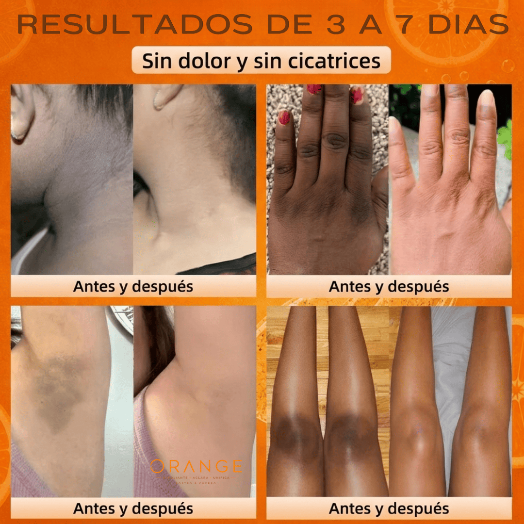 ORANGE™ Exfoliante Rostro y Cuerpo Aclarador de Manchas