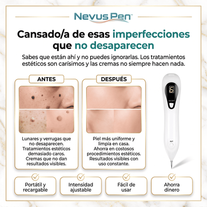 Nevus Pen™ Lapiz Cauterizador Elimina Verrugas y Lunares