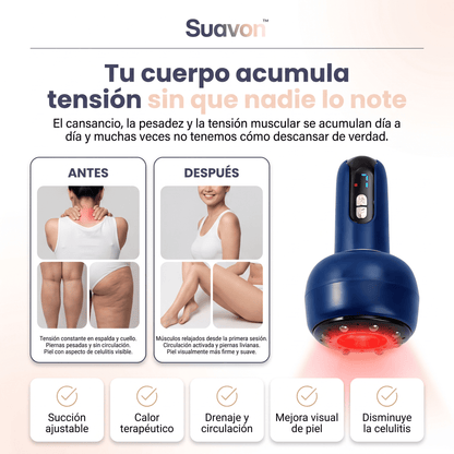 Suavon™ Masajeador de Terapia con Succión,Reductor Celulitis