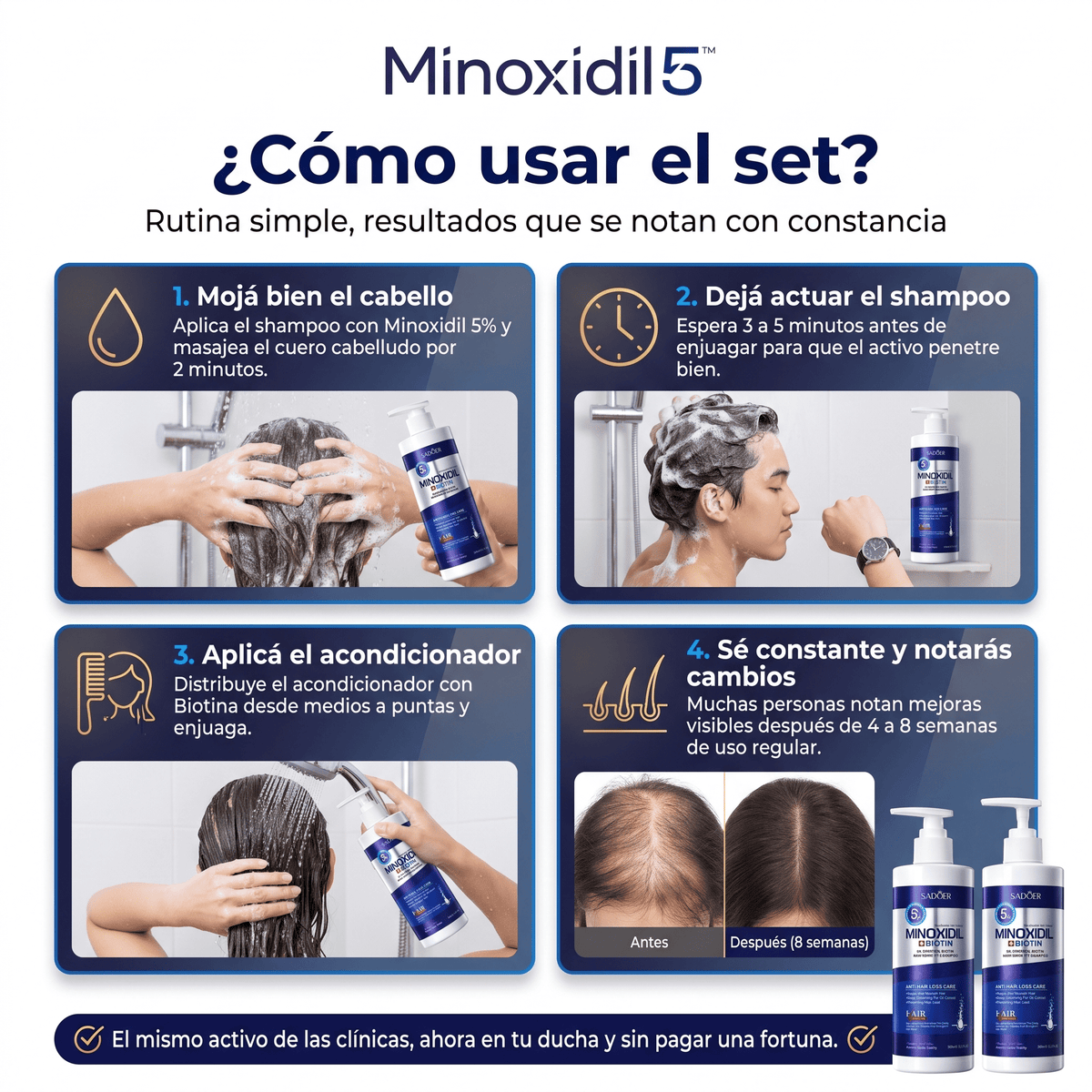 Minoxidil 5™ Set Shampoo + Acondicionador - Reduce Caída y Favorece Crecimiento Capilar