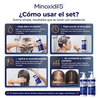 Minoxidil 5™ Set Shampoo + Acondicionador - Reduce Caída y Favorece Crecimiento Capilar